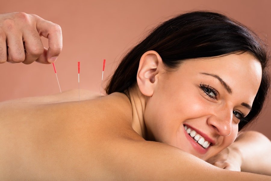 benefits of acupuncture