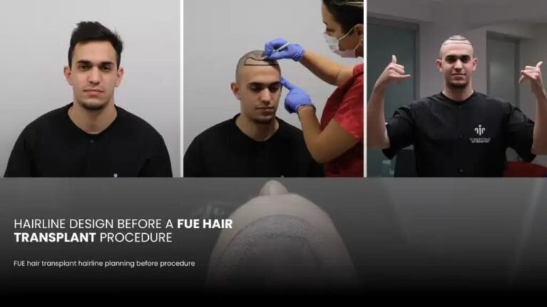 risks and complications of a hair transplant